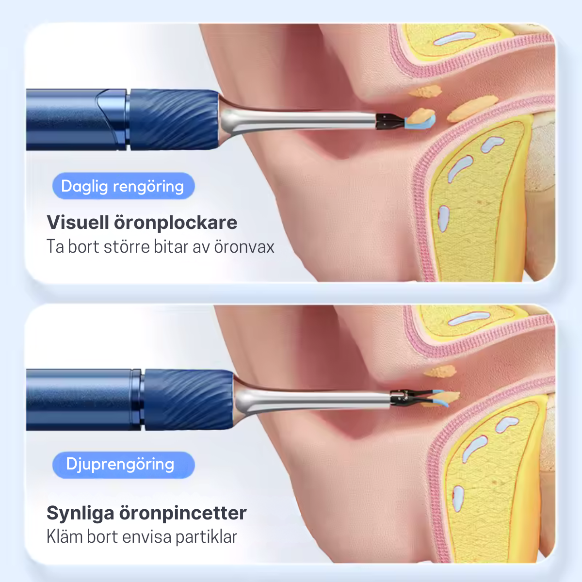 Smart Öronrengörare med HD-kamera